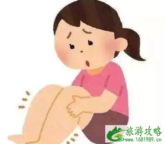 坐飞机腿肿是什么原因 坐飞机腿肿怎么办